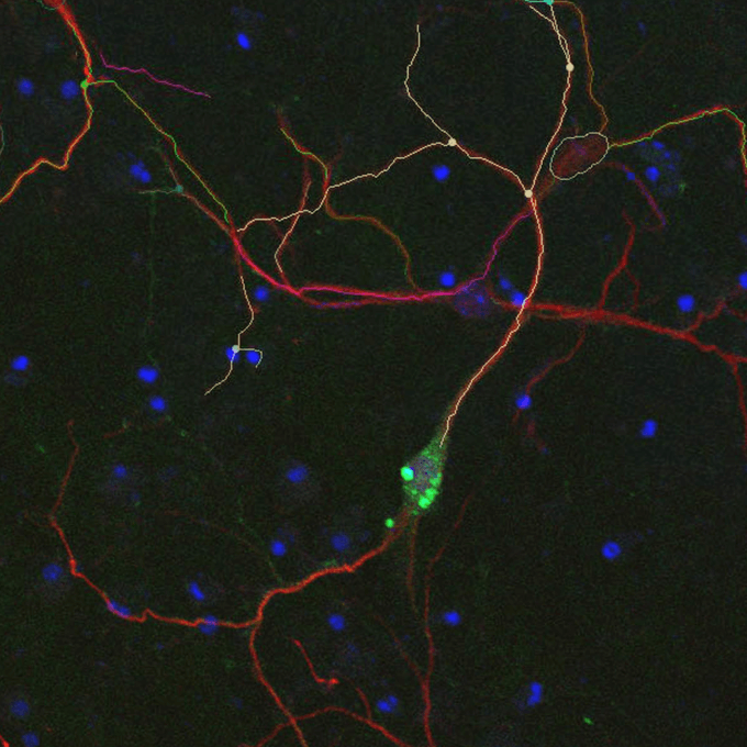 Mitochondrial dysfunction | RIKEN Center for Brain Science - Lab. for Molecular Dynamics of Mental Disorders